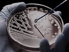 Penicillin led to complacency OIP 31 - Penicillin led to complacency