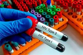 Monkeypox isn’t like HIV OIP 33 - Monkeypox isn’t like HIV
